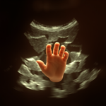 Einblicke in die 16. bis 18. SSW: Die spannende Entwicklung des Babys